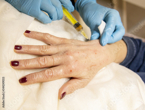 carrying out the procedure of plasmolifting on the hands of an elderly woman procedure of rejuvenation and moisturizing of hands