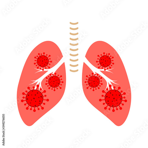 Coronavirus or bacteria  in human lugs. Vector illustration.