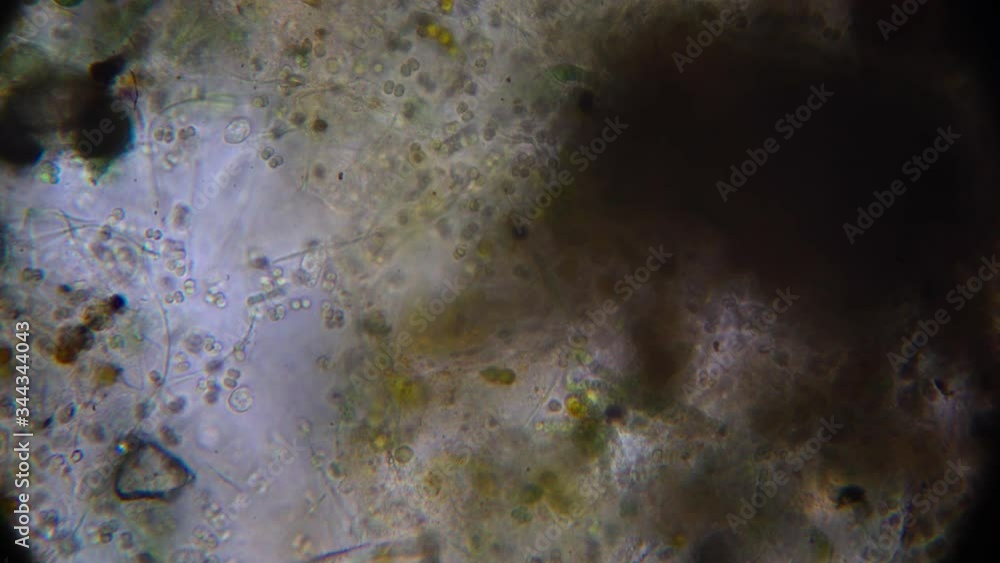 a variety of simple organisms in the aquatic environment, taken under a microscope a variety of simple organisms in the aquatic environment, taken under a microscope