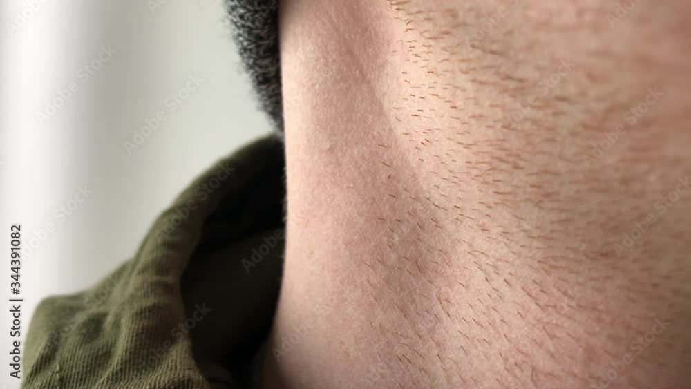 Pulse beats in the artery on the male neck. High blood pressure. Pulse beats in the artery on the male neck. High blood pressure.
