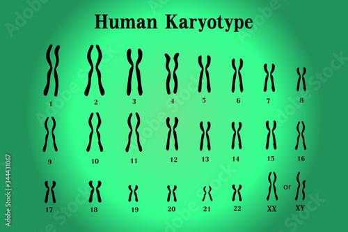 Karyotype of normal human chromosome illustration vector