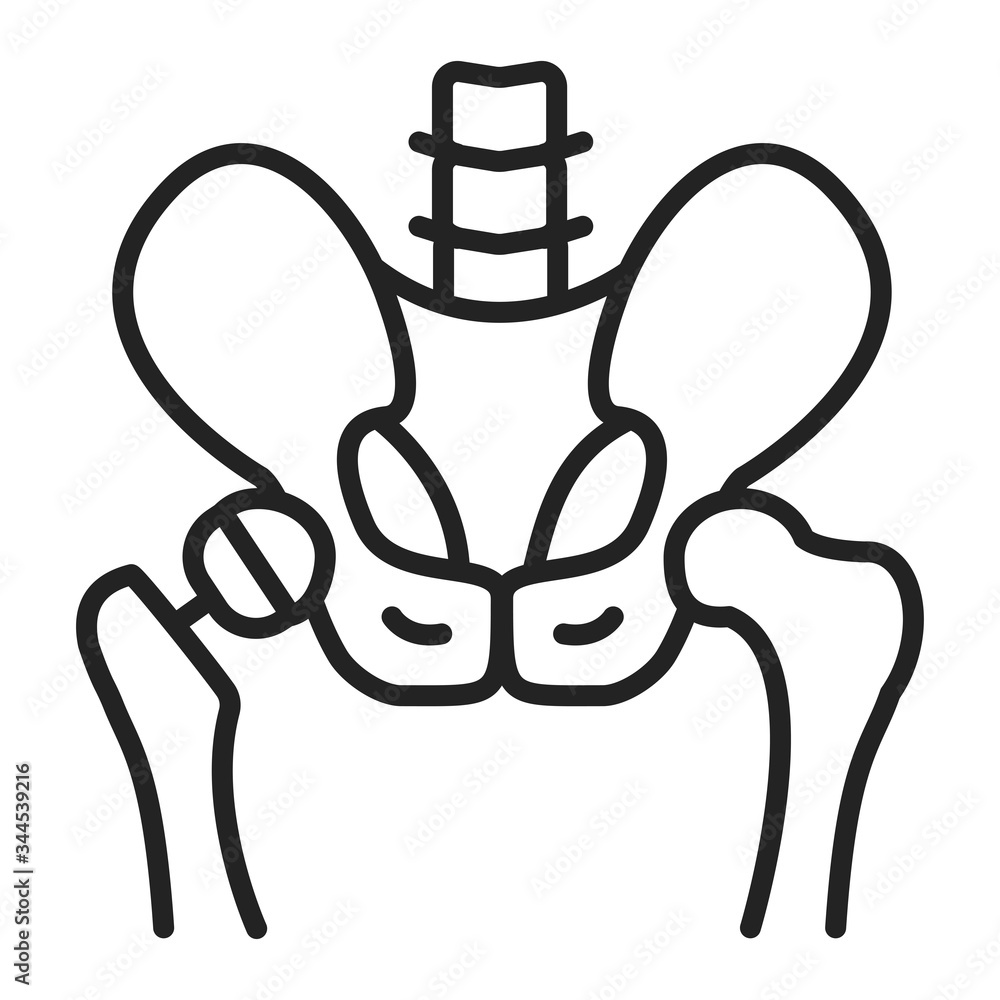 arthroplasty-line-black-icon-hip-replacement-implant-installed-in-the