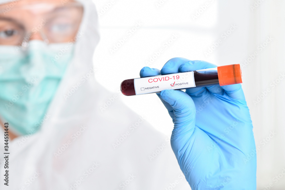 COVID-19 Positive Test on Hand COVID-19 Positive Test on Hand