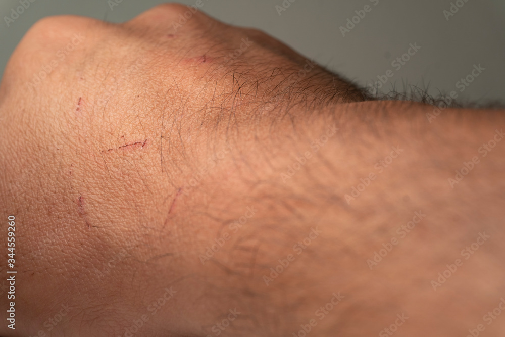 Fototapeta premium Hands and fingers in detail.