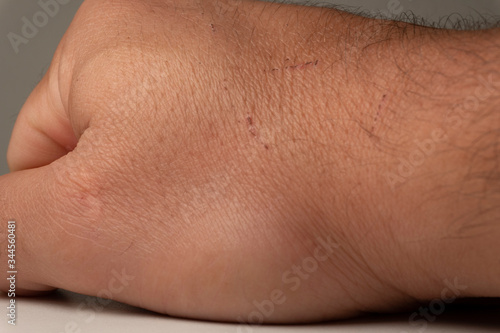Hands and fingers in detail.