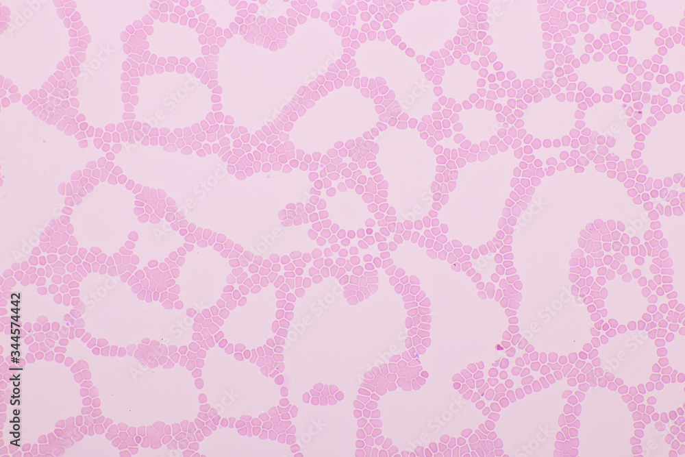 Red blood cells in blood smear, Wright-Giemsa stain, analyze by microscope, 400x Red blood cells in blood smear, Wright-Giemsa stain, analyze by microscope, 400x