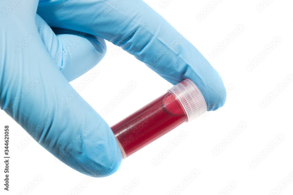 Blood test tube in doctor hand with blue medical gloves. Blood test tube in doctor hand with blue medical gloves.