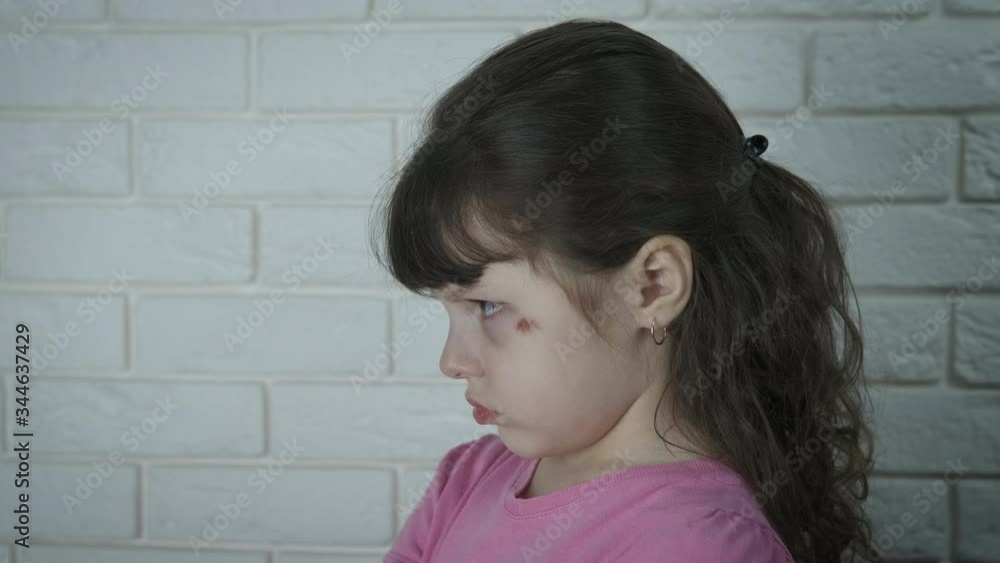 Offended child. Offended little girl with wounds on her face. Offended child. Offended little girl with wounds on her face.