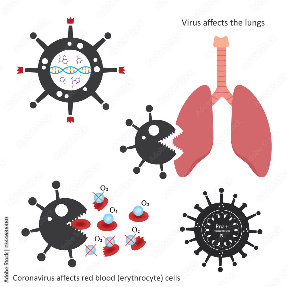 Vector medicinal illustration concept. Coronavirus Covid -19 affects parts of human organism