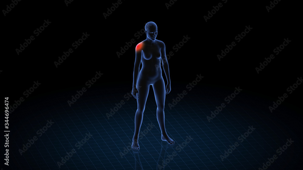 Girl with pathology. 3d body of women. Female human figure. Girl with pathology. 3d body of women. Female human figure.