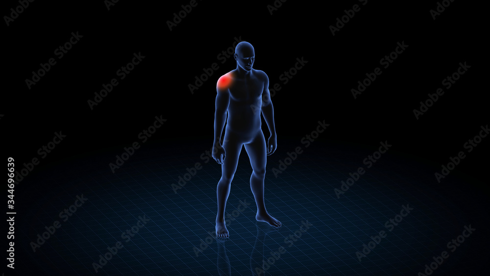 Man with pathology. 3d body of boy. Male human figure. Man with pathology. 3d body of boy. Male human figure.