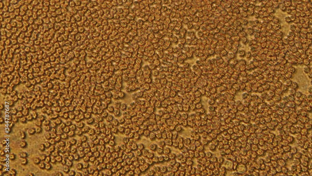 Microscopy of human blood cell test. Magnification 300x moving of red blood cells in detail under microscope. Laboratory analisis. Microscopy of human blood cell test. Magnification 300x moving of red blood cells in detail under microscope. Laboratory analisis.