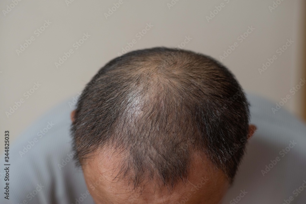 Obraz premium 薄毛