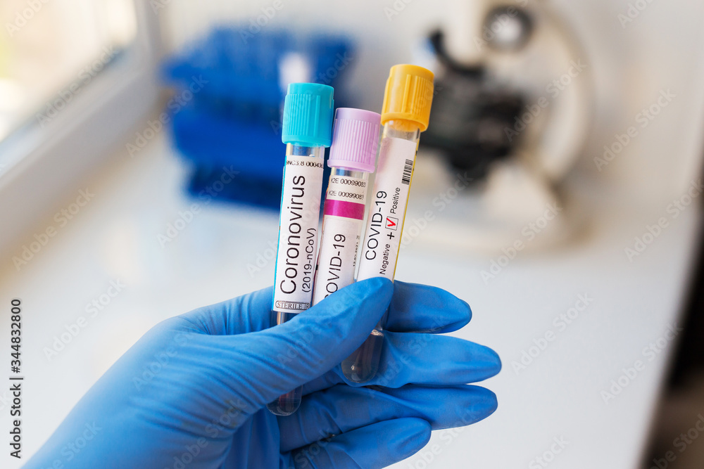 Coronavirus blood test in hospital laboratory. Covid-19 test Coronavirus blood test in hospital laboratory. Covid-19 test