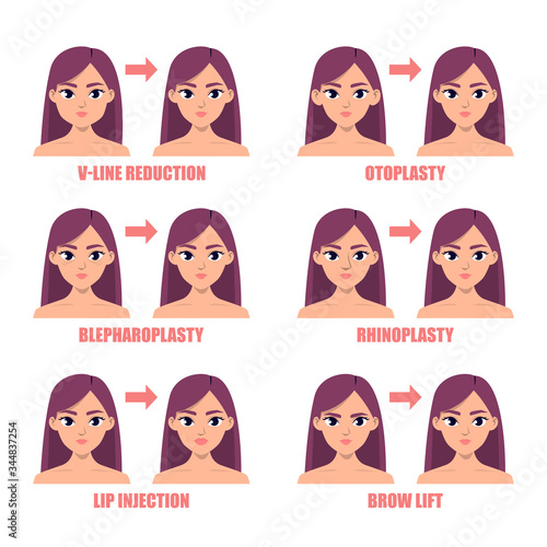 Types of plastic surgery on the face