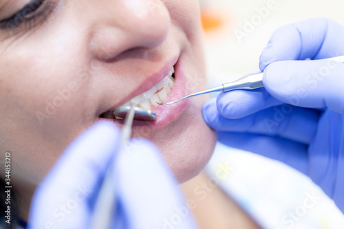dentist checking patient mouth close up view