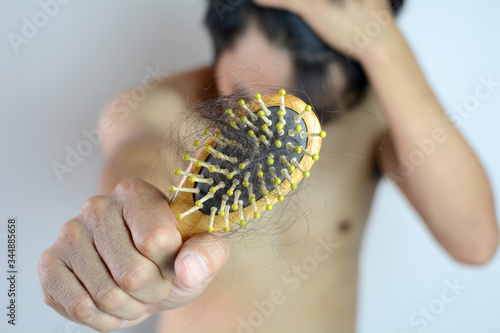 Hair loss, hair fall everyday serious problem, man worried for hair loss and problem hair on white background.