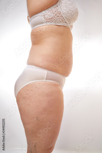 legs, buttocks and stomach of a 40-year-old woman with stretch marks, cellulite and varicose veins on a white isolated background photo