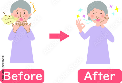 口臭に悩むおばあちゃんのビフォーアフター