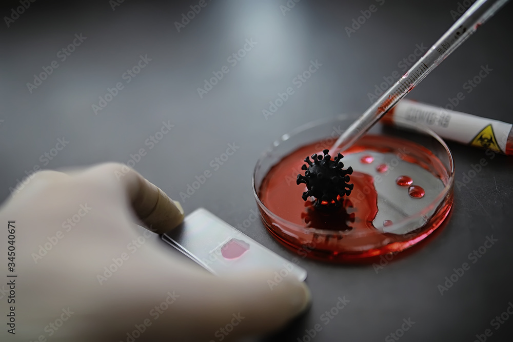 Test tube with patient blood for testing. Analysis for the virus. Coronavirus pandemic laboratory studies. Vaccine development. Test tube with patient blood for testing. Analysis for the virus. Coronavirus pandemic laboratory studies. Vaccine development.