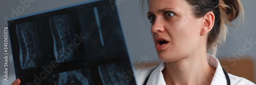 Obraz na płótnie Portrait of experienced surprised pediatrician holding skiagram of unhealthy person. Doctor looking at snap with horrified. Healthcare and medicine concept w salonie