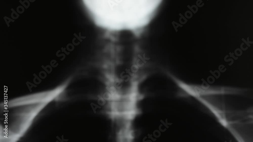 Human radiology for codiv virus diagnosis