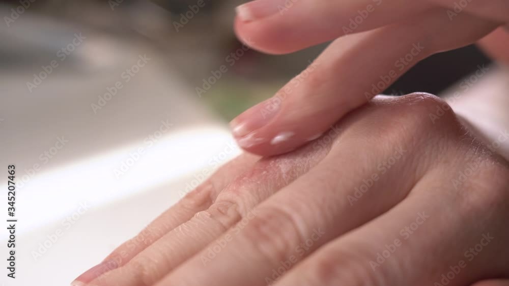 Girl or woman smears eczema on her hands with special healing ointment. Red swollen fingers require urgent treatment to improve patient health. Woman rubs one finger. Close up macro. Girl or woman smears eczema on her hands with special healing ointment. Red swollen fingers require urgent treatment to improve patient health. Woman rubs one finger. Close up macro.