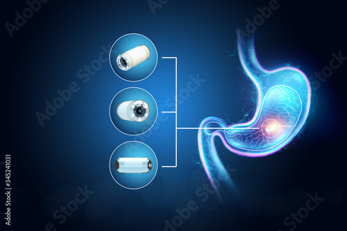 Doctor against the background of a hologram of the stomach, A camera the size of a capsule in the stomach, an endoscopy procedure. Digestive tract disease concept. 3D rendering, 3D illustration. photo