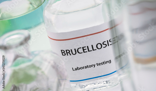 Test brucellosis in laboratory, conceptual image photo