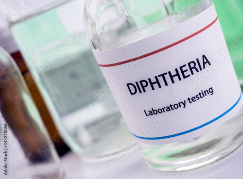 Foto Test diphtheria in laboratory, conceptual image, composition horizontal