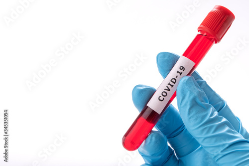Chemistry laboratory research Covid-19 or Coronavirus blood test tube and examination gloves, medical and science concept
