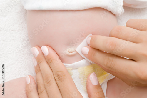 Fotografie Young mother hand wiping newborn navel with alcohol pad