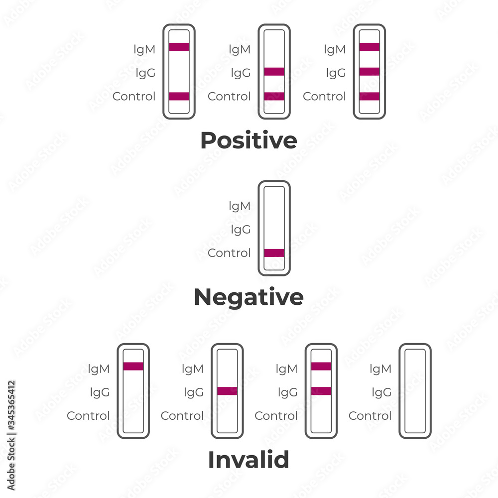 COVID 19 rapid test kit results interpretation infographics showing COVID 19 rapid test kit results interpretation infographics showing