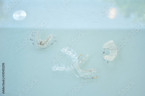 歯科矯正の種類