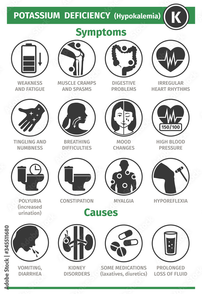 Symptoms and Causes of Potassium deficiency. Template for use in medical agitation. Vector illustration, flat icons.