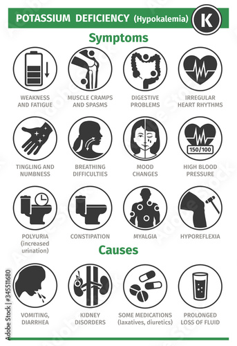 Symptoms and Causes of Potassium deficiency. Template for use in medical agitation. Vector illustration, flat icons. photo