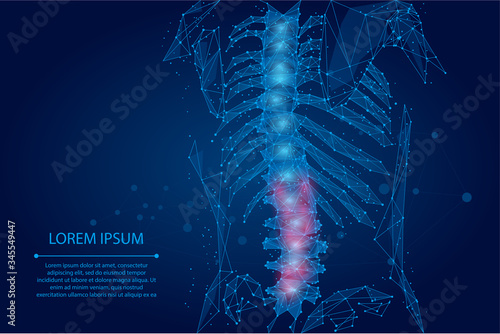 Abstract mesh line and dot physiotherapy human spine. Low poly Pain area surgery operation. Polygonal render female back hernia vector illustration