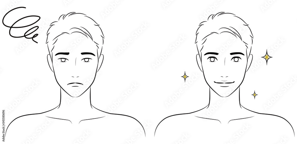 Double eyelid surgery before and after vector illustration for men. Double eyelid surgery before and after vector illustration for men.