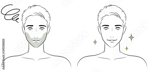 men's facial hair or beard removal before after concept, vector illustration