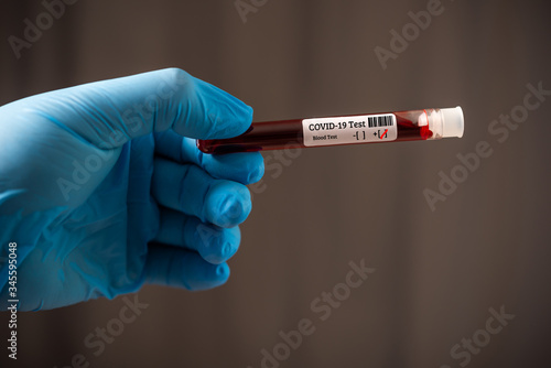 doctor hand wearing blue glove holding blood test tube