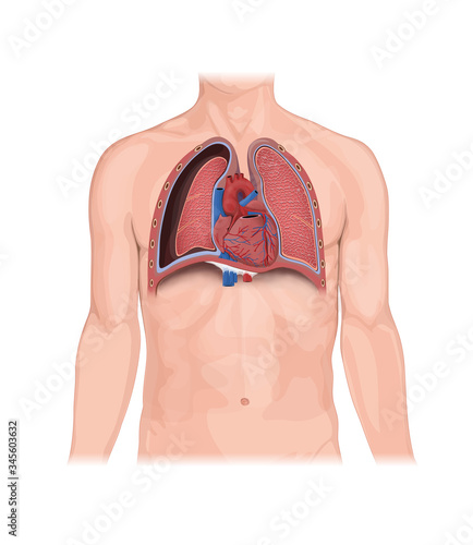 Pneumothorax, Human Anatomy, illustration, lungs, heart, Collapsed lung. abnormal collection of air