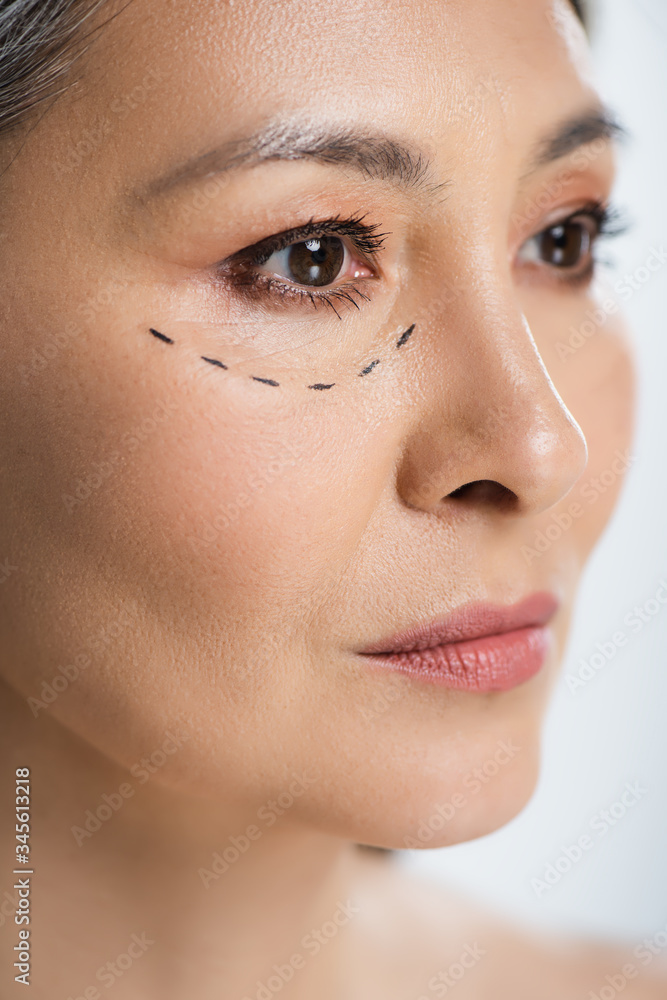 asian woman with plastic surgery lines on face isolated on grey