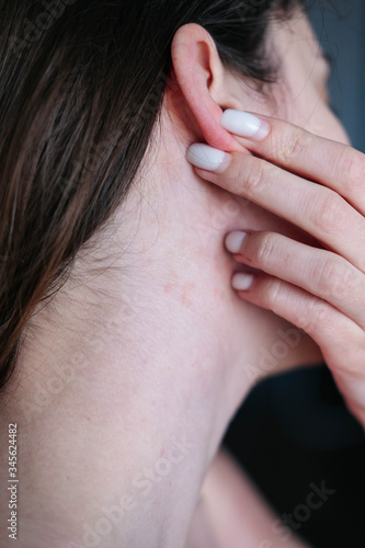 dandruff on the girls head, diseases of the scalp
