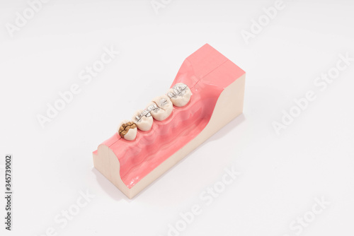 Dental education and study model of teeth.