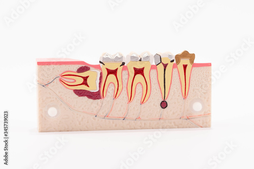 Dental education and study model of teeth.