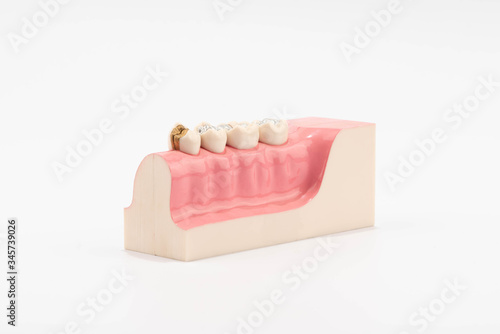 Dental education and study model of teeth.