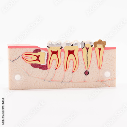 Dental education and study model of teeth.