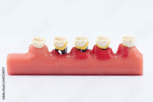 Dental education and study model of teeth.