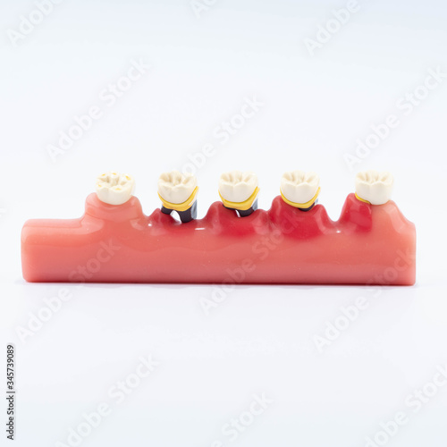 Dental education and study model of teeth. photo