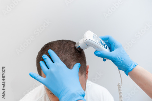 Trichoscopy of hair and scalp closeup. Trichoscope in the hands of a doctor